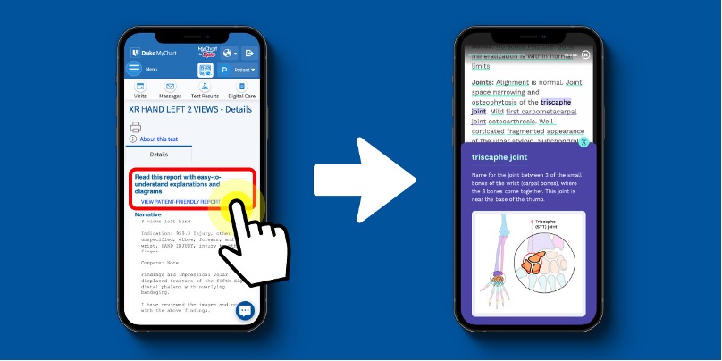 Lo nuevo y próximo en Duke MyChart | Duke Health